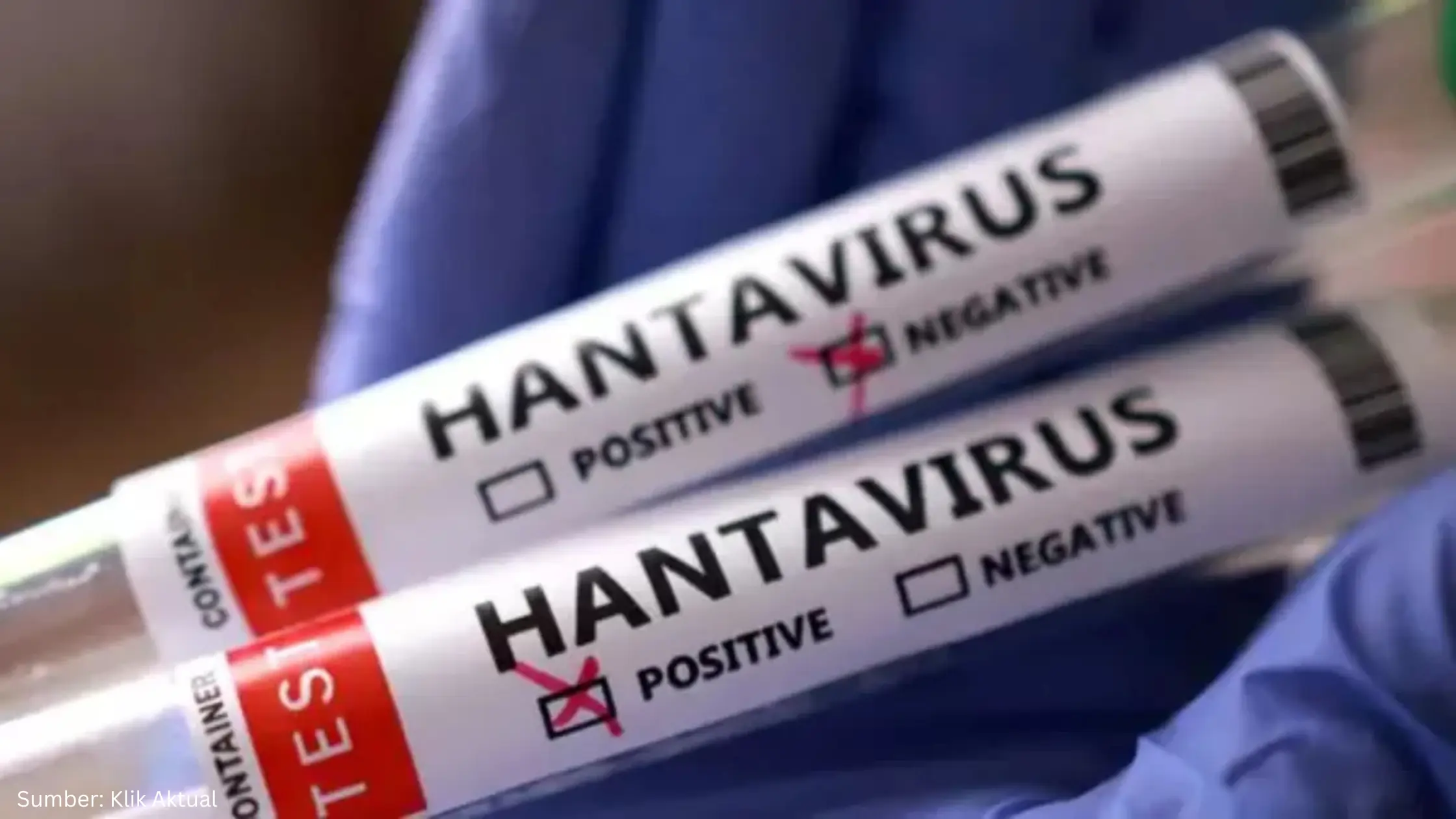 5 Fakta Hantavirus di Indonesia yang Harus Kamu Tahu